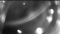Bazén