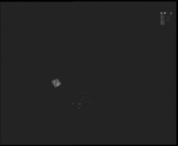 Terasa horského hotelu