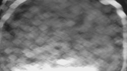 Bílá - běžecká trať