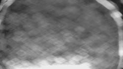 Lyžařské svahy, Smrk, Lysá hora