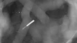 Areál koupaliště Holešov