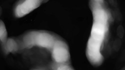 Areál koupaliště Holešov