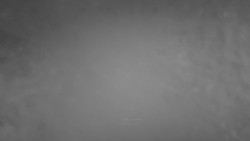 Lanovka - pohled nahoru