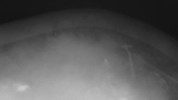 Lanovka - pohled nahoru