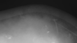 Lanovka - pohled nahoru