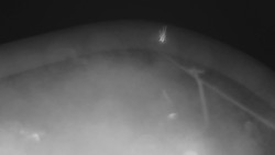 Lanovka - pohled nahoru