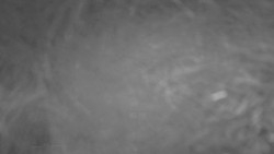 Lanovka - pohled nahoru