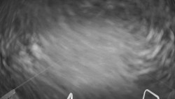 Lanovka - pohled dolů