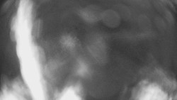 Lanovka - pohled dolů