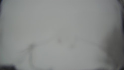 Lanovka - pohled dolů