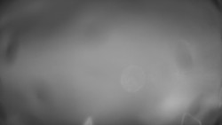 Lanovka - pohled dolů