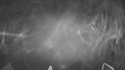 Lanovka - pohled dolů