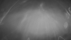 Lanovka - pohled dolů