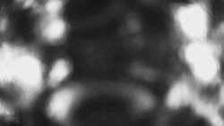 Lanovka - pohled dolů