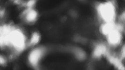 Lanovka - pohled dolů