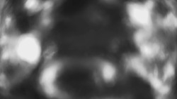 Lanovka - pohled dolů