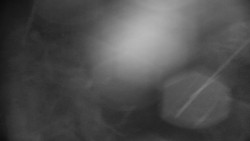 Praděd - Petrovy kameny