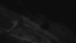 Přístup na běžeckou trať