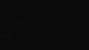 Sporthotel Kurzovní - Přístup na běžeckou trať - 17.4.2026 v 00:35 Sporthotel Kurzovní - Přístup na běžeckou trať - 17.4.2026 v 00:35