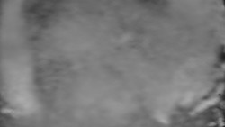 Otočná kamera na sjezdovce