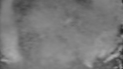 Otočná kamera na sjezdovce