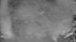 Otočná kamera na sjezdovce