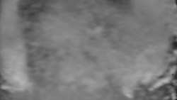 Otočná kamera na sjezdovce