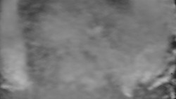 Otočná kamera na sjezdovce