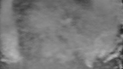 Otočná kamera na sjezdovce