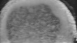 Otočná kamera na sjezdovce