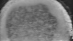 Otočná kamera na sjezdovce