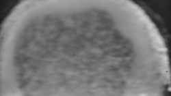 Otočná kamera na sjezdovce