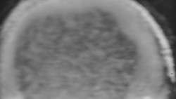 Otočná kamera na sjezdovce