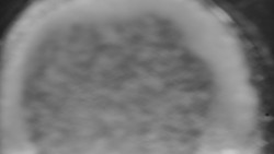 Otočná kamera na sjezdovce