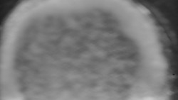 Otočná kamera na sjezdovce