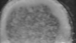 Otočná kamera na sjezdovce