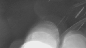 SKICENTRUM Miroslav Lipová Lázně - Dojezd hlavní sjezdovky - 26.11.2025 v 01:25 SKICENTRUM Miroslav Lipová Lázně - Dojezd hlavní sjezdovky - 26.11.2025 v 01:25