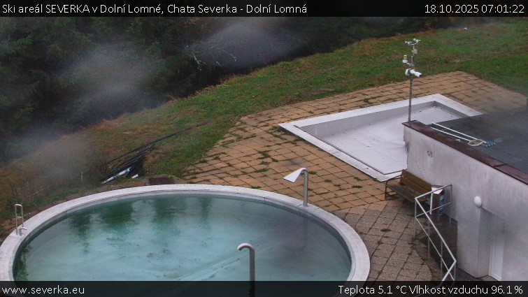Ski areál SEVERKA v Dolní Lomné - Chata Severka - Dolní Lomná - 18.10.2025 v 07:01 Ski areál SEVERKA v Dolní Lomné - Chata Severka - Dolní Lomná - 18.10.2025 v 07:01