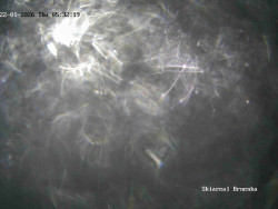 Sjezdovka, Vernířovice