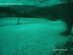 Sjezdovka, Vernířovice