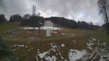 Skiareál Lázeňský vrch