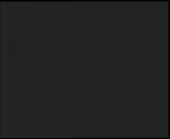 SkiAreál - Horský hotel...