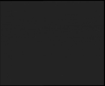 SkiAreál - Horský hotel...