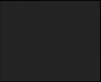 SkiAreál - Horský hotel...