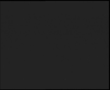 SkiAreál - Horský hotel...