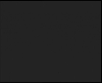 SkiAreál - Horský hotel...