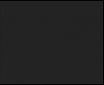 SkiAreál - Horský hotel...