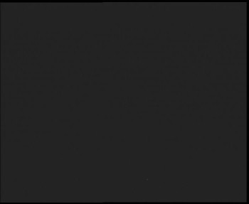 SkiAreál - Horský hotel...