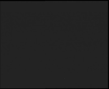 SkiAreál - Horský hotel...