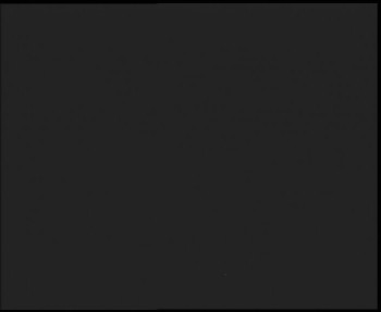 SkiAreál - Horský hotel...